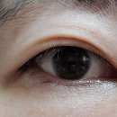 서울베스트안과의원 이미지