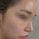 더큐어 | 라디셀 어드밴스드 인텐시브 큐어 에센스 사용후기 속건조 케어에 만족했던 수분에센스