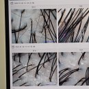 필리아빌딩 | 시청역 두피관리 <담혜원스칼프라운지> 1인 VIP룸에서 임산부가 감동한 디테일 (ft. 엑소뮨/플라즈마)