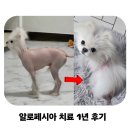 1 | 알로페시아 포메 탈모 극복, 약물 없는 엑시머 치료 1년 후기