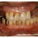 수플란트치과병원 이미지