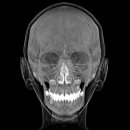 서일메디칼 이미지