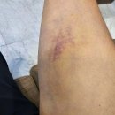 연세힐링재활의학과의원 티스토리