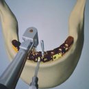 서울탑프란트치과의원 이미지