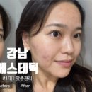삿에스떼