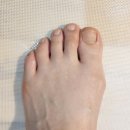 매료네일 문제성전문점 | 평택내성발톱 관리 잘하는 곳, 네일수아비 문제성발톱관리 후기