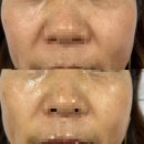 메리미의원 | [안산] 안산 고잔동 섬세한 피부관리! 콜드 플라즈마 기미,잡티관리는 #메리미뷰티 에서!