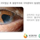 홍채안경원 이미지