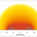 이온메디칼 이미지