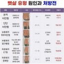 허리통증 경근도수 후기 이미지