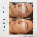 오늘, 피부어때