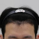 압구정맘모스헤어라인의원 이미지