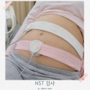 NST | NST 검사 언제 하나요 막달 태동 검사 후기와 검사시간 총정리