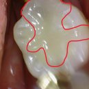 퍼즐치과기공소 이미지