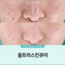 고운피부에스테틱 이미지