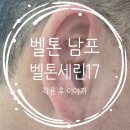 (유)응급환자이송일이구 | [공지] 소음 많은 병원에서도 선명하게 – 벨톤보청기 남포청각센터 세린 착용 후기