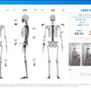 엠지테라피