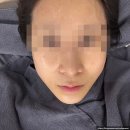 르헤브 스킨케어 | 쌍촌동 여드름 관리 맛집) 르헤브스킨케어 후기