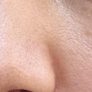 (주)메디타임 | 코피지제거를 위해 메디타임 포어 블랙헤드 원샷 팩 사용후기