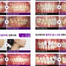 원치과기공소 이미지