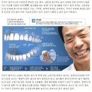 치아 (齒牙)의 명칭(名稱)과 기능(機能) 이미지