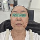 안심플러스의원 | 창원 상남동 실로스의원 / 실리프팅 받고온 후기