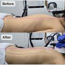 서우목장 | 광주 일곡동 체형관리 서우뷰티 다리붓기 마사지 셀룰라이트 빼는법