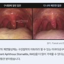 나노덴탈치과기공소 | 입덧완화 임산부치약, 임플란트 관리 무불소치약 '순수백과 제로치약'