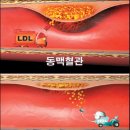 "나쁜콜레스테롤 낮추는 음식 베스트 9" 이미지