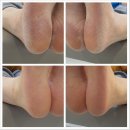 페디네일 이미지