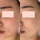 모이라에스테틱&모공세척광산점 | 피부관리 모이라에스테틱 광주점 광주 광산구 신창동 가격위치주소이벤트할인 총정리