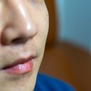 진해물재생센터 설비동 | 명동 을지로피부과 레이저 남자 수염 제모 포토나아발란체 후기