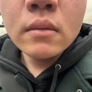 샤인더마의원 이미지