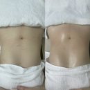 인계동 1115-14 | [수원] 수원바디관리 다이어트는 라인미뷰티에서