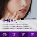 안면홍조[hot flush] 이미지