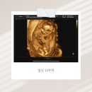 기형아검사 • 장꾸맘 각도법 • 엽산 졸업 • 14주 배크기 • 베페 베이비페어 • 동작구 임신맘 도우미