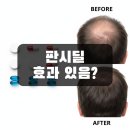 (주)기반 | 판시딜 효과 실화일까? 후기 기반으로 정리해봤어요