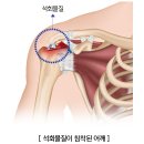 세종시365으랏차한의원 네이버블로그