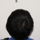 부산 맘모스헤어라인의원 이미지