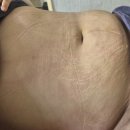 부천 오정동 벨리타맘케어 광명부천점 출장 산후마사지 후기