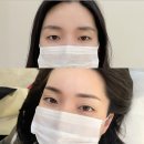 성남 디자인 | 성남눈썹문신 디자인을 맞춰가며 본 후기