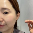 쥬에르스킨