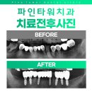 라임플란트치과의원 이미지