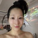 사라메디칼 | [임암동] 비온 스킨 (BEON SKIN)에서 피부관리 받은 직후솔직 후기&amp; 모습