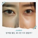 예쁜라인성형외과의원