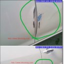 덴트렉스 이미지