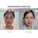 보니토 에스테틱 | 광주신부관리 보니토에스테틱 티리온-X 웨딩 전 관리 후기