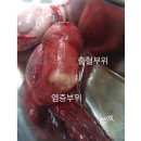 고환염전(torsion) 이미지