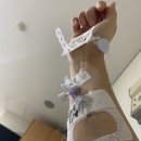 원전 보건진료소 | 발작성심실상성빈맥 #PSVT재발 후 3번째시술 (#전극도자절제술, #신촌세브란스병원 )