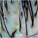 해송초등학교 | 장산역 모공관리 거품으로 빼는 두피디톡스 올가드림뷰티 해운대래미안점